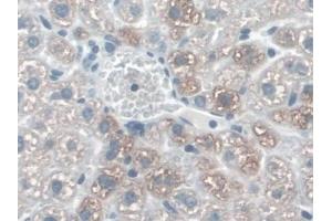 DAB staining on IHC-P; Samples: Mouse Liver Tissue (Cadherin 5 antibody  (AA 67-390))