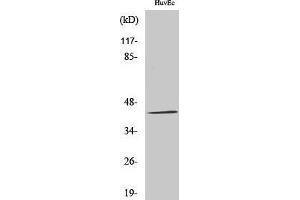 Western Blotting (WB) image for anti-Galactokinase 1 (GALK1) (N-Term) antibody (ABIN3184735) (GALK1 antibody  (N-Term))