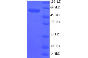 ART1 Protein (AA 23-295) (GST tag)