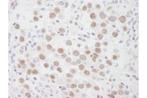 Immunohistochemistry (IHC) image for anti-DEAD (Asp-Glu-Ala-Asp) Box Polypeptide 1 (DDX1) (AA 500-550) antibody (ABIN7448512) (DDX1 antibody  (AA 500-550))