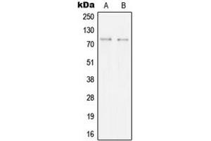 Western blot analysis of SYK expression in BJAB (A), Ramos (B) whole cell lysates. (SYK antibody  (Center))
