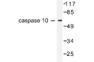 Image no. 1 for anti-Caspase 10, Apoptosis-Related Cysteine Peptidase (CASP10) antibody (ABIN265334) (Caspase 10 antibody)