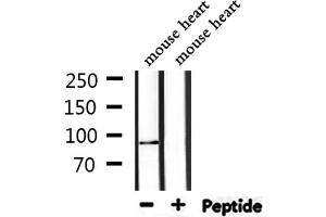 Western blot analysis of extracts from mouse heart, using TOP1 Antibody. (Topoisomerase I antibody  (Internal Region))