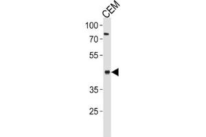 Western Blotting (WB) image for anti-Fatty Acid Desaturase 2 (FADS2) antibody (ABIN3002322) (FADS2 antibody)