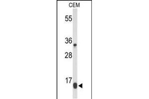 Western blot analysis of DIRAS1 Antibody (Center) (ABIN653351 and ABIN2842831) in CEM cell line lysates (35 μg/lane). (DIRAS1 antibody  (AA 109-136))