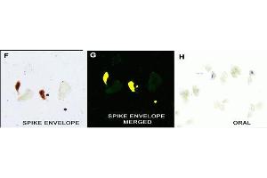 IHC Validation in COVID-19 Patient Sample: (Nuovo et al. (SARS-CoV-2 Envelope antibody  (N-Term))