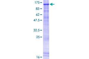 ERCC3 Protein (AA 1-782) (GST tag)
