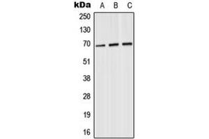Western blot analysis of SLU7 expression in HeLa (A), SP2/0 (B), PC12 (C) whole cell lysates.