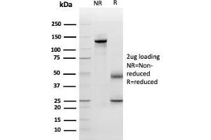 SDS-PAGE Analysis Purified Periostin (POSTN) Mouse Monoclonal Antibody (POSTN/3501). (Periostin antibody  (AA 193-326))