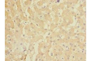 Immunohistochemistry of paraffin-embedded human liver tissue using ABIN7154473 at dilution of 1:100 (GADD45G antibody  (AA 1-159))