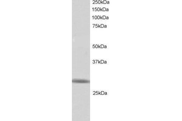 RNF141 antibody  (C-Term)