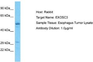 Host: Rabbit Target Name: EXOSC3 Sample Type: Esophagus Tumor lysates Antibody Dilution: 1.