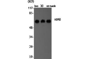 Western Blotting (WB) image for anti-Heat Shock 60kDa Protein 1 (Chaperonin) (HSPD1) antibody (ABIN5956900) (HSPD1 antibody)