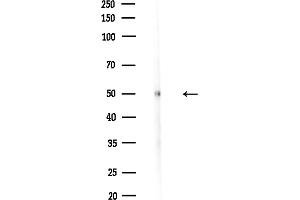 anti-Gasdermin D (GSDMD) antibody