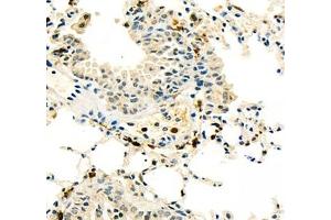 Immunohistochemistry (Paraffin-embedded Sections) (IHC (p)) image for anti-Baculoviral IAP Repeat Containing 3 (BIRC3) antibody (ABIN7073179)