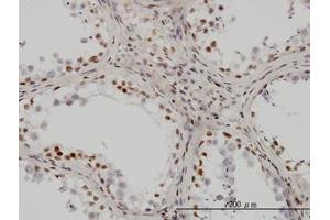 Image no. 3 for anti-Upstream Binding Transcription Factor, RNA Polymerase I (UBTF) (AA 551-651) antibody (ABIN599001) (UBTF antibody  (AA 551-651))