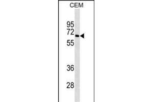 BLNK Antibody ABIN1539928 western blot analysis in CEM cell line lysates (35 μg/lane). (B-Cell Linker antibody  (AA 150-178))