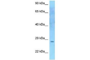 WB Suggested Anti-SOCS2 Antibody Titration: 1. (SOCS2 antibody  (C-Term))
