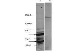Western Blot of Rabbit anti-HDAC2 antibody. (HDAC2 antibody  (C-Term))