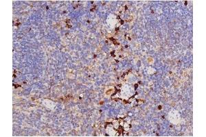 Immunohistochemistry (IHC) image for anti-Microtubule-Associated Protein tau (MAPT) (pThr212) antibody (ABIN6256508)