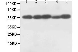 Western Blotting (WB) image for anti-Caspase 8 (CASP8) (AA 240-259), (Middle Region) antibody (ABIN3044361) (Caspase 8 antibody  (Middle Region))