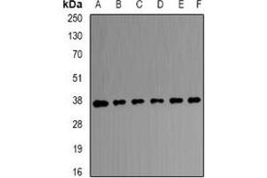 Western blot analysis of Transaldolase expression in HEK293T (A), A431 (B), SW480 (C), mouse brain (D), mouse kidney (E), rat liver (F) whole cell lysates. (TALDO1 antibody)
