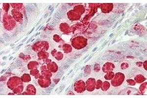 Detection of TFF3 in Human Colon Tissue using Polyclonal Antibody to Trefoil Factor 3 (TFF3) (TFF3 antibody  (AA 22-80))