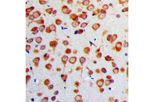 Immunohistochemical analysis of Gamma-enolase staining in human brain formalin fixed paraffin embedded tissue section. (ENO2/NSE antibody  (C-Term))