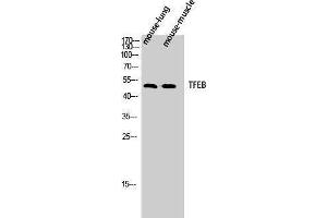 Western Blotting (WB) image for anti-Transcription Factor EB (TFEB) (N-Term) antibody (ABIN3187234) (TFEB antibody  (N-Term))