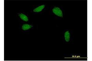 Immunofluorescence of purified MaxPab antibody to TCF2 on HeLa cell.