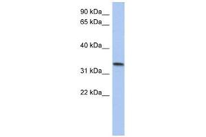 C10ORF96 antibody used at 1 ug/ml to detect target protein. (C10ORF96 antibody  (Middle Region))