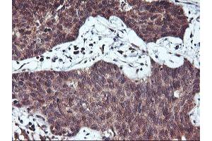 Image no. 5 for anti-Haloacid Dehalogenase-Like Hydrolase Domain Containing 1 (HDHD1) antibody (ABIN1498625) (HDHD1 antibody)