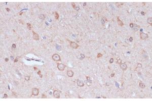 Immunohistochemistry of paraffin-embedded Rat brain using CARTPT Polyclonal Antibody at dilution of 1:100 (40x lens). (CARTPT antibody)