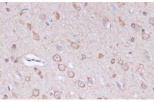 Immunohistochemistry of paraffin-embedded Rat brain using CARTPT Polyclonal Antibody at dilution of 1:100 (40x lens).