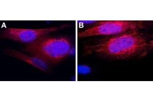 Expression of Thyrotropin-releasing hormone receptor 1 in mouse MS1 cellsImmunocytochemical staining of mouse pancreatic islet endothelial (MS1) cells.
