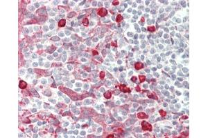 Formalin-fixed and paraffin-embedded H. (SENP6 antibody  (C-Term))