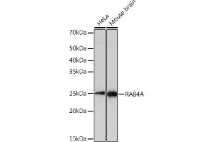 Western blot analysis of extracts of various cell lines, using RA Rabbit mAb (ABIN1680998, ABIN3018369, ABIN3018370 and ABIN7101603) at 1:1000 dilution. (Rab4 antibody)