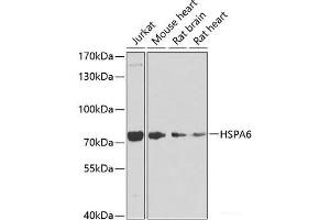 Western blot analysis of extracts of various cell lines using HSPA6 Polyclonal Antibody at dilution of 1:1000. (HSPA6 antibody)