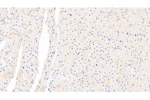 Detection of XRN1 in Human Cardiac Muscle Tissue using Polyclonal Antibody to 5'-3'Exoribonuclease 1 (XRN1) (XRN1 antibody  (AA 1394-1706))