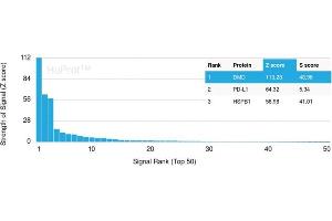Analysis of Protein Array containing more than 19,000 full-length human proteins using Dystrophin Monospecific Mouse Monoclonal Antibody (DMD/3245). (Dystrophin antibody  (AA 114-263))