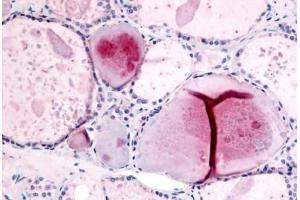 Human Thyroid (formalin-fixed, paraffin-embedded) stained with PDE8B antibody ABIN213535 at 10 ug/ml followed by biotinylated goat anti-rabbit IgG secondary antibody ABIN481713, alkaline phosphatase-streptavidin and chromogen. (PDE8B antibody  (Internal Region))