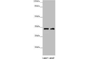 Western blot All lanes: CENPK antibody at 3. (CENPK antibody  (AA 1-269))