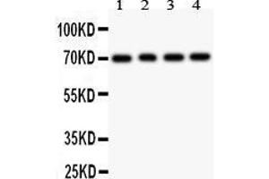 Anti- FOXO1A antibody, Western blotting All lanes: Anti FOXO1A  at 0. (FOXO1 antibody  (AA 456-655))