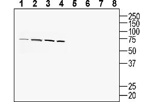 Western blot analysis of human  MG glioblastoma cell line lysate (lanes 1 and 5), human  colon adenocarcinoma cell line lysate (lanes 2 and 6), human  monocytic leukemia cell line lysate (lanes 3 and 7) and mouse  microglia cell line lysate (lanes 4 and 8):1-4. (PACC1 (AA 95-110), (Extracellular) antibody)