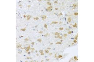 Immunohistochemistry of paraffin-embedded mouse brain using Gm13125 antibody. (Pramel15 antibody  (AA 67-274))