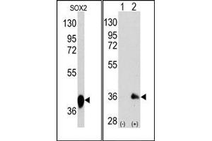 Western Blotting (WB) image for anti-SRY (Sex Determining Region Y)-Box 2 (SOX2) antibody (ABIN356387) (SOX2 antibody)