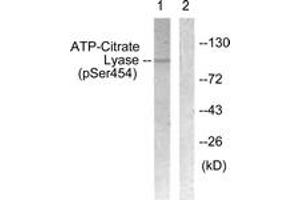 Western blot analysis of extracts from COS7 cells treated with Calyculin 50nM 30', using ATP-Citrate Lyase (Phospho-Ser454) Antibody. (ACLY antibody  (pSer455))