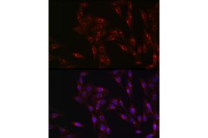 Immunofluorescence analysis of NIH/3T3 cells using MR1 Rabbit pAb (ABIN6131925, ABIN6143983, ABIN6143984 and ABIN6224070) at dilution of 1:100 (40x lens). (MR1 antibody  (AA 20-260))