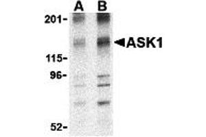 Western Blotting (WB) image for anti-Mitogen-Activated Protein Kinase Kinase Kinase 5 (MAP3K5) (N-Term) antibody (ABIN1031241) (ASK1 antibody  (N-Term))