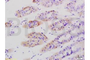 Formalin-fixed and paraffin embedded mouse stomach tissue labeled with Anti-Tenascin C/Tn-C Polyclonal Antibody, Unconjugated (ABIN736761) at 1:200 followed by conjugation to the secondary antibody and DAB staining (TNC antibody  (AA 1001-1100))